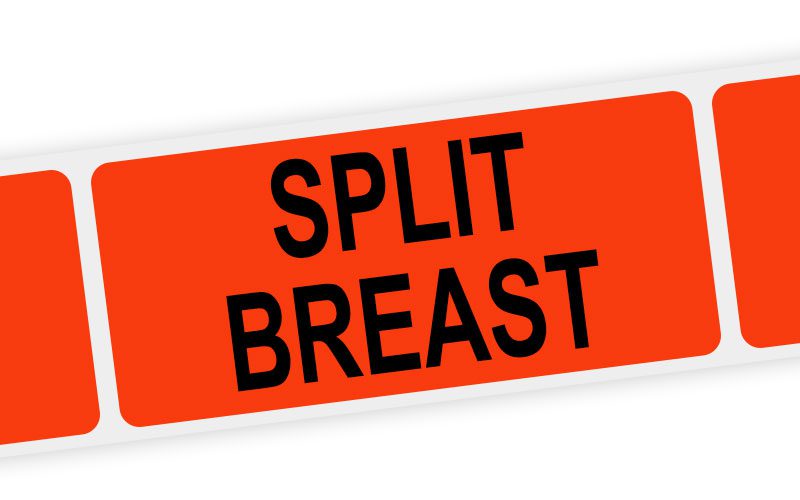 split breast label